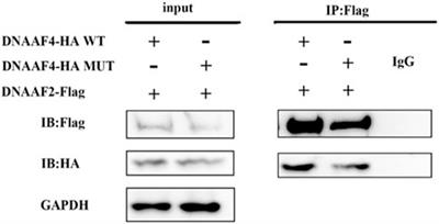 Homozygous mutation in DNAAF4 causes primary ciliary dyskinesia in a Chinese family